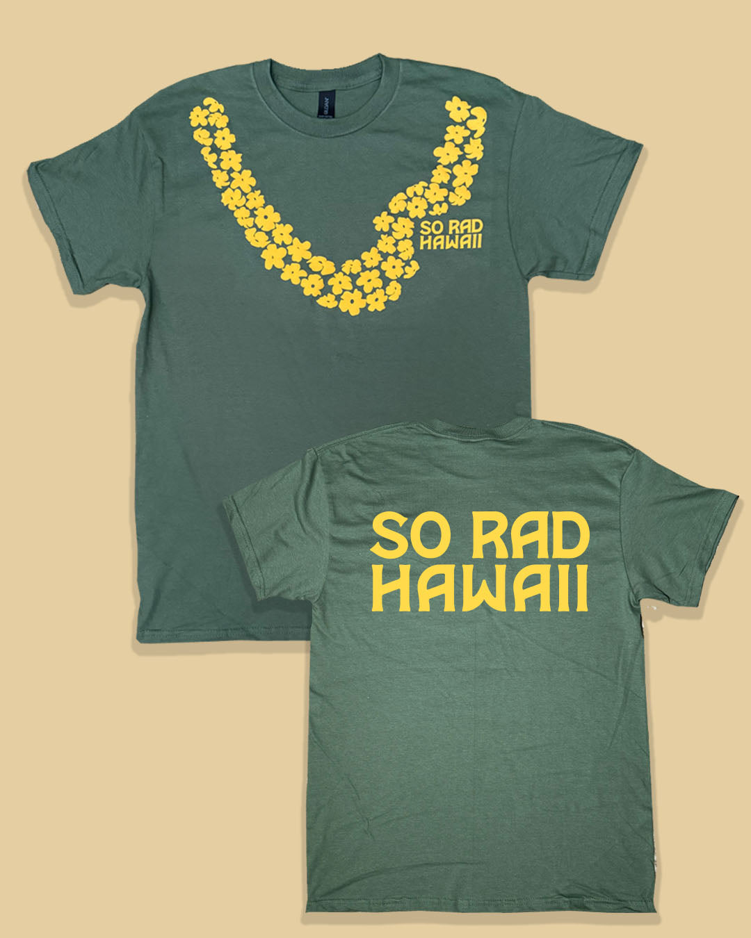 So Rad Lei